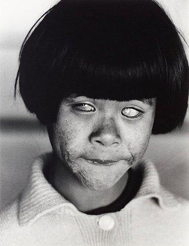 The Blind girl, Hiroshima